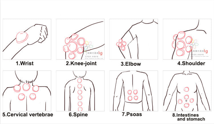 Silicone vacuum cupping cupper - The Mobility Kit