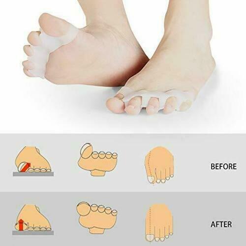 2 Toe Separators Straightener Toes Spacer Bunion Corrector Feet Foot Pain Relief