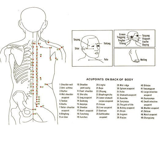 Silicone vacuum cupping cupper - The Mobility Kit